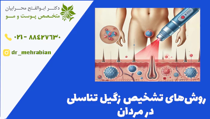 روش‌های تشخیص زگیل تناسلی
 در مردان