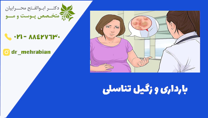 بارداری و زگیل تناسلی