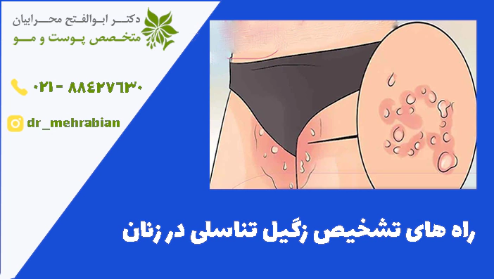 راه های تشخیص زگیل تناسلی در زنان