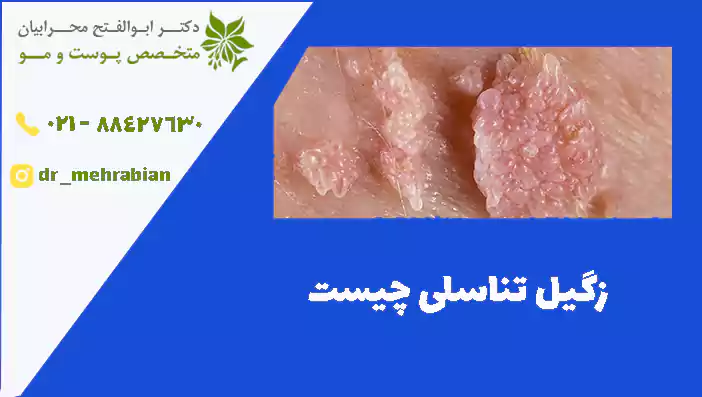 زگیل تناسلی چیست؟
