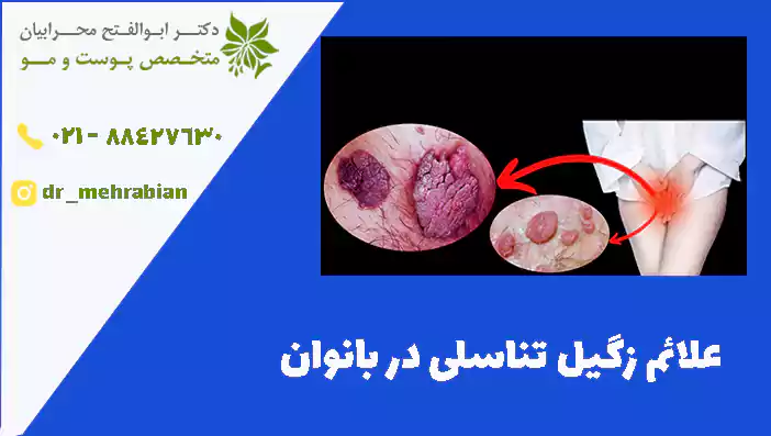 علائم زگیل تناسلی در بانوان
