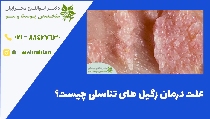 علت درمان زگیل های تناسلی چیست؟