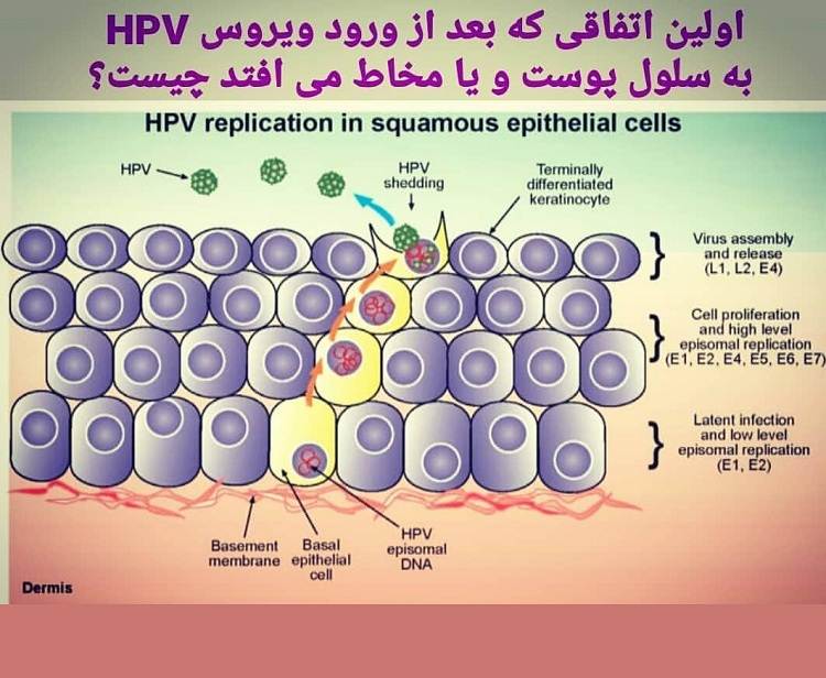 آیا زگیلهای تناسلی سرطانی می شوند؟