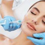 تزریق ژل و فیلر برای جوانسازی پوست صورت - نواحی تزریق ژل