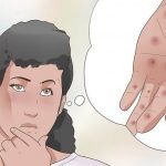علائم سیفیلیس