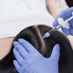 مزوتراپی مو تقویت و پرپشت کردن موهای کم پشت و ضعیف با مزوتراپی