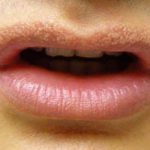 نقاط فوردایس