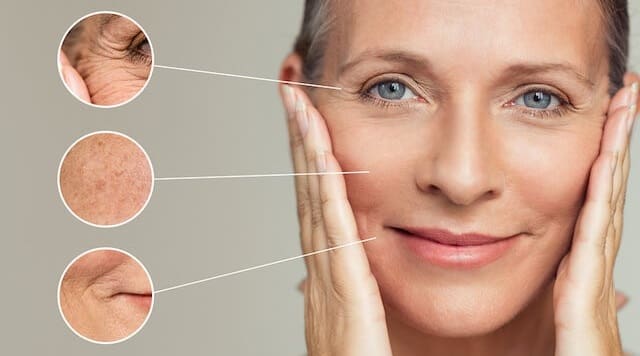 چه مناطقی از پوست با هایفو قابل درمان است؟